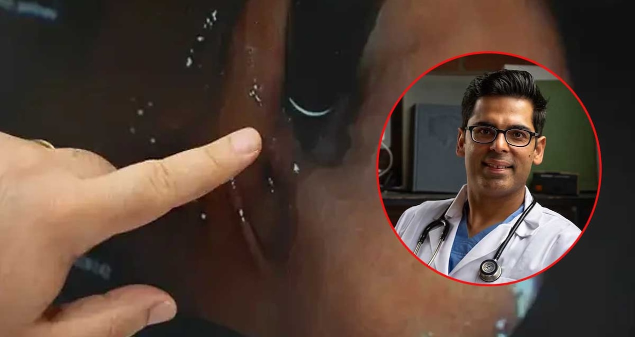 Harvardli doktor detoksa gerek yok dedi bagirsaklari genc tutmanin 4 formulunu verdi GD4TpO1G